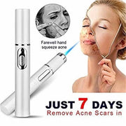 Therapy Acne Laser Pen Soft Scar Wrinkle Removal Treatment InformationEssentials