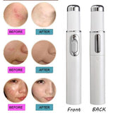 Therapy Acne Laser Pen Soft Scar Wrinkle Removal Treatment InformationEssentials